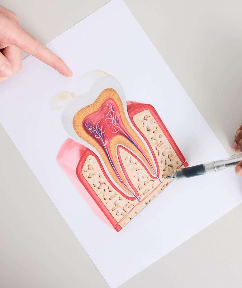 cross section of tooth | dental implants Sydney