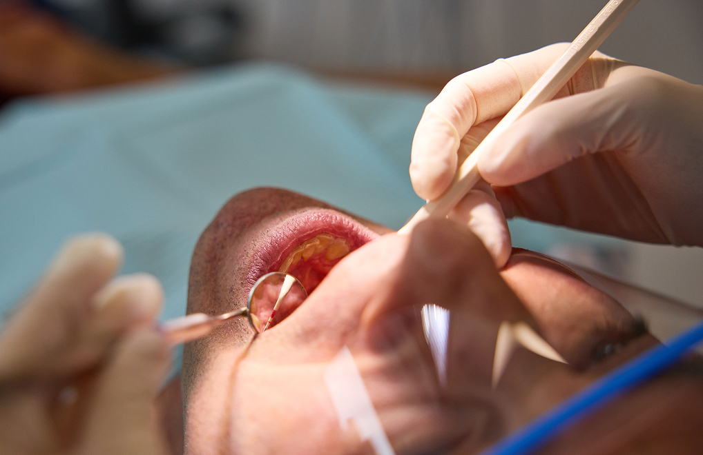 dental checkup | dental implants Sydney