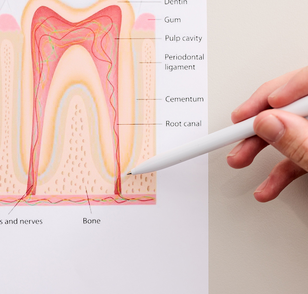 Signs Your Child May Need Regenerative Endodontics 2